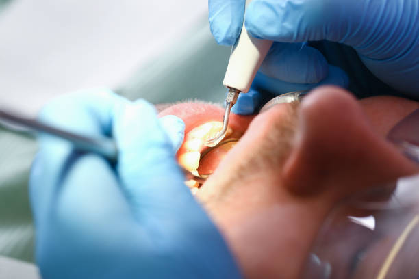 Best Affordable Emergency Dental Care  in Camp Springs, MD
